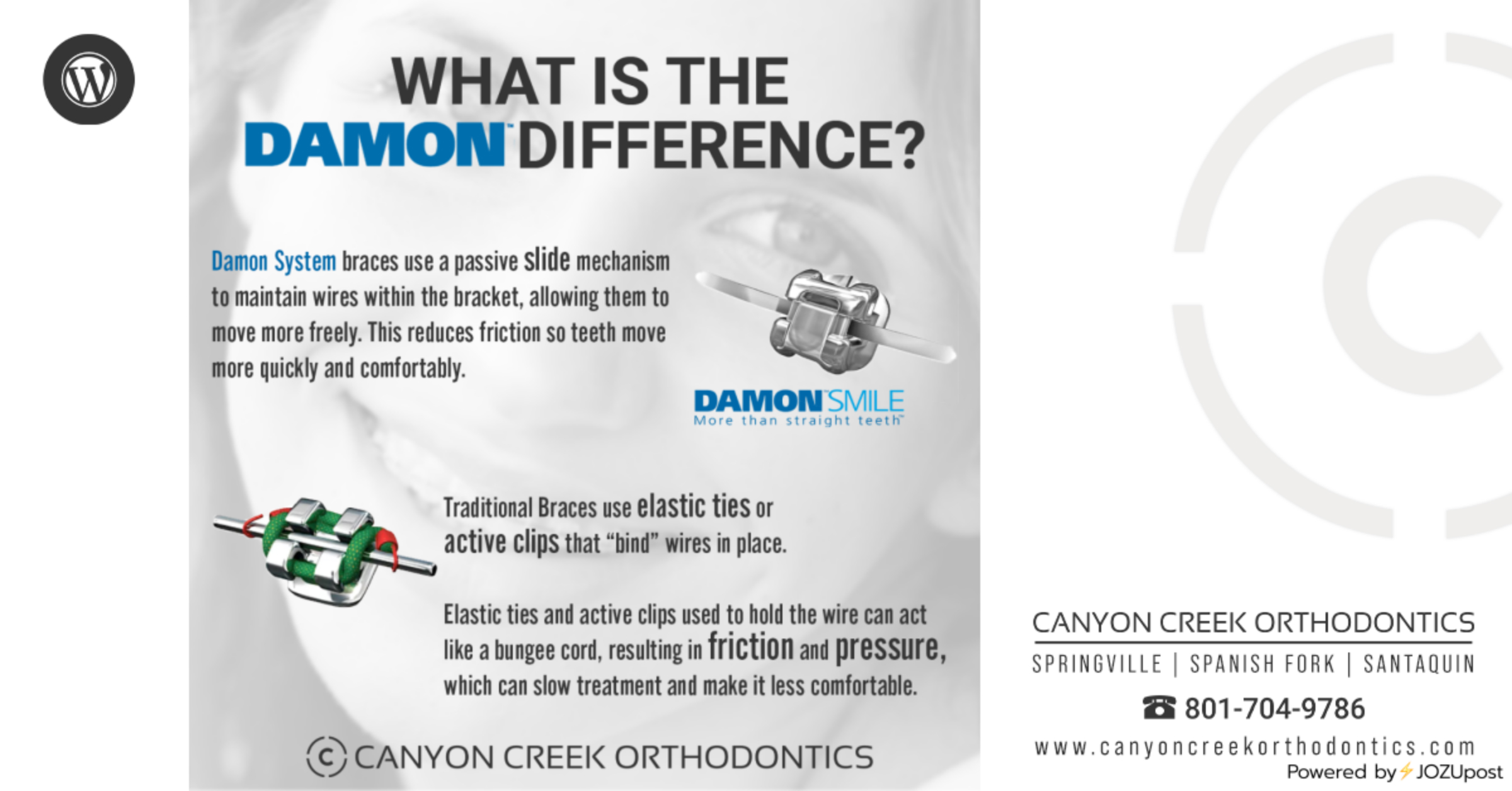 Damon Braces Difference