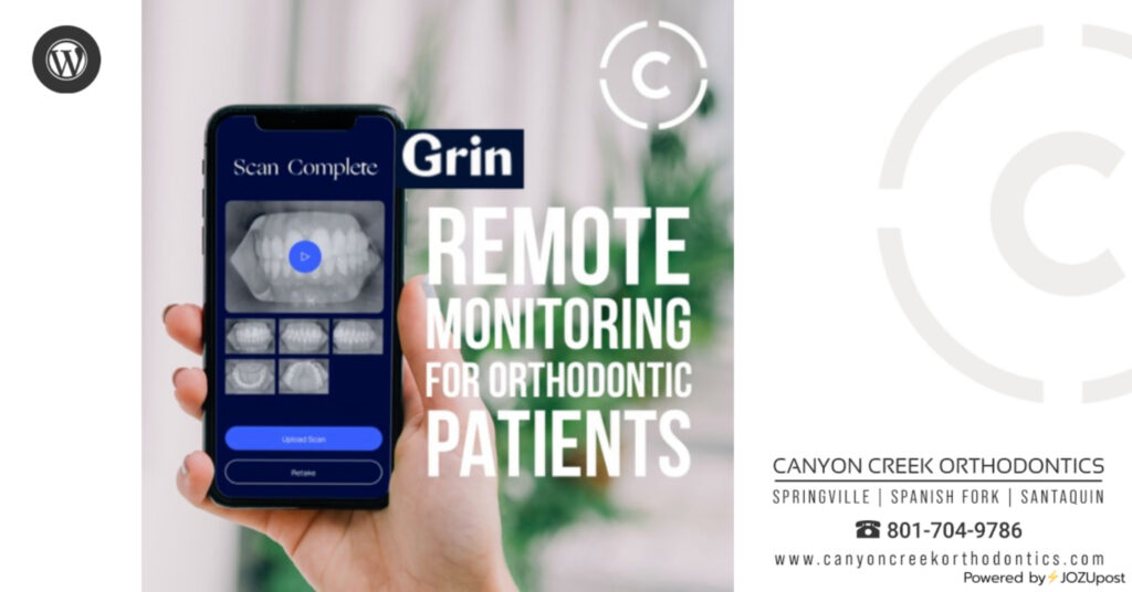 Remote Monitoring With Grin
